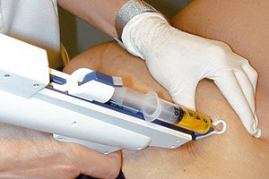 Mezoterapia ciała